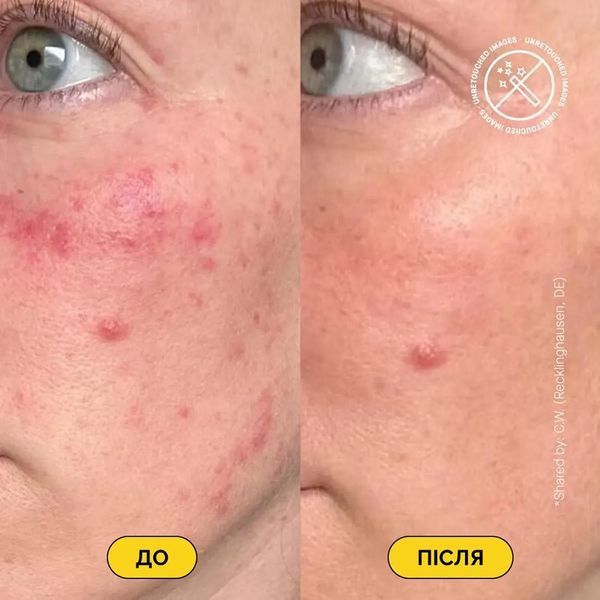 Сироватка з високою дозою керамідів Theramid Ceramide Treatment 2_04_063 фото