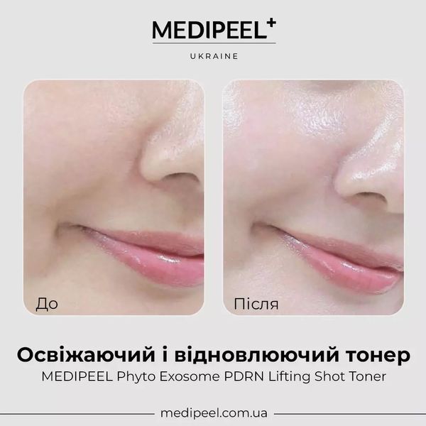 Антивіковий ліфтинг-тонер MEDI PEEL PHYTO EXOSOME PDRN LIFTING SHOT TONER 130 ML 2_03_011 фото
